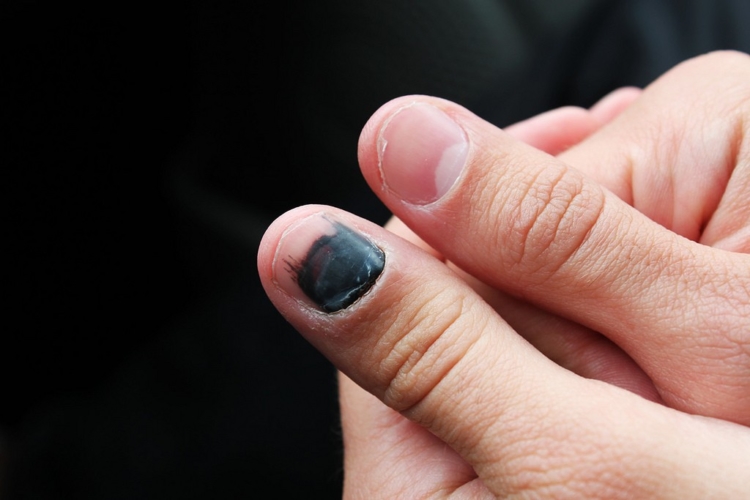 Вот о чем может рассказать цвет ваших ногтей: важные сигналы организма