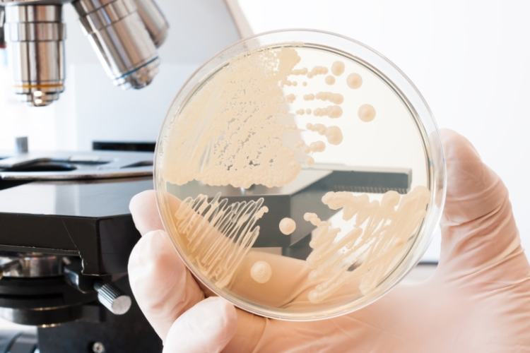 Живет в каждом из нас: чем опасен кандидоз, симптомы, как не заболеть